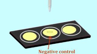 Agglutination assay to detect antigens  MultiLingual Captions [upl. by Nayve301]