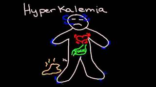 Hyperkalemia [upl. by Lower]