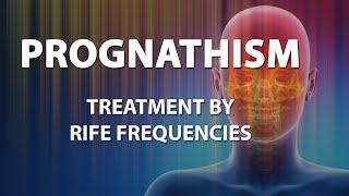 Prognathism  RIFE Frequencies Treatment  Energy amp Quantum Medicine with Bioresonance [upl. by Verina336]