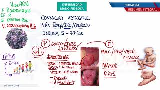 Pediatría  Exantemas Enfermedad M P B [upl. by Ardnosac]