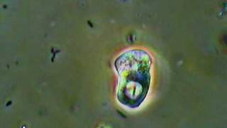 Active Amoeba Feeding [upl. by Hildie]