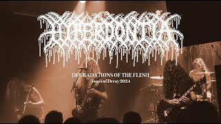 Hyperdontia  Degradations of the Flesh Live at Tones of Decay  Prague Czech Republic 2024 [upl. by Cleodal]