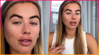 Love Islands Arabella Chi reveals she was diagnosed with PCOS after suffering a secret miscarriage [upl. by Carolin]