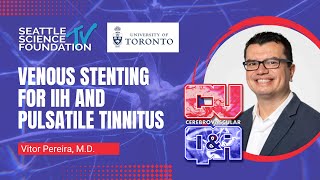 Venous Stenting For IIH And Pulsatile Tinnitus  Vitor Pereira MD [upl. by Faruq]