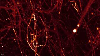 Glutamatergic neurons in the mouse brain sparse labeling [upl. by Spiro]