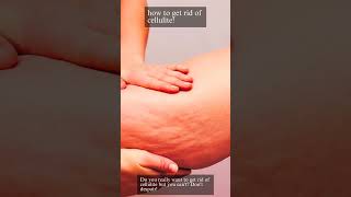 How To Get Rid Of Cellulite cellulitis skincare [upl. by Annawal986]