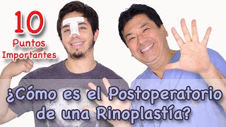 ¿Cómo es el Postoperatorio de una Rinoplastía [upl. by Airdnal]