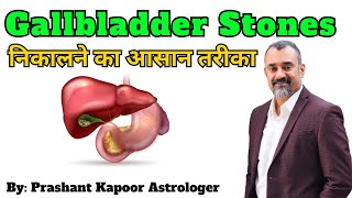 Simple way to remove GALLBLADDER stones with Naturopathy and Medical Astrology by Prashant Kapoor [upl. by Bald634]