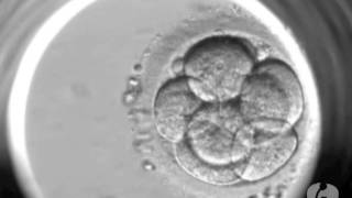 Evolução dos embriões no Laboratório de Reprodução Humanawmv [upl. by Smail]