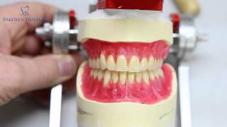 How Dentures Are Made [upl. by Chase]