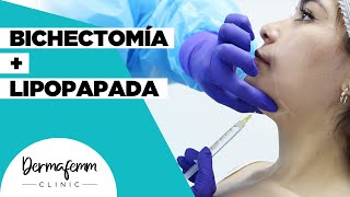 APLICACIÓN DE LIPOPAPADA  BICHECTOMÍA [upl. by Rovner546]