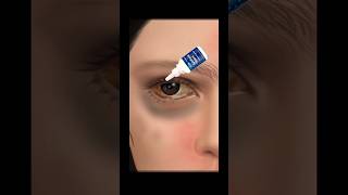 Augentropfen animation augenoptik asmr [upl. by Lyons]