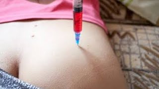 How to Give an IM Intramuscular injection in the Buttocks  Dorsogluteal hip Technique 👨‍⚕ [upl. by Gnaig]