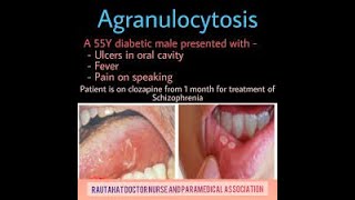 Agranulocytosis Symptoms and Causes  Diagnosis  Treatment  Prevention [upl. by Zsolway442]