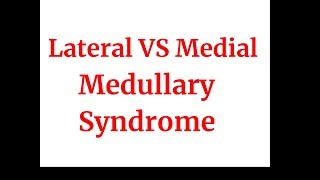 Lateral VS medial medullary syndrome [upl. by Ynnig]