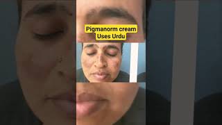 Pigmanorm cream Uses in urduHindi  Pigmanorm whitening cream  pigmanorm cream  Dr Nadeem [upl. by Oad715]