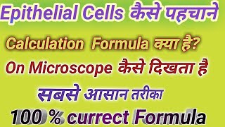 Epithelial cells in urine  Epithelial cells under microscope  How to identify epithelial cells [upl. by Rramaj471]