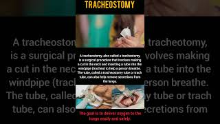 Tracheostomy newchannel physiotherapy movie supportme tracheostomy emergency procedure [upl. by Orlene]