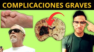 9 COMPLICACIONES GRAVES con DIABETES Mucho cuidado [upl. by Netti]