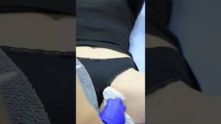 Bikini Hair Removal Period Dilemmas [upl. by Ailbert]