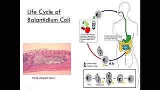 Balantidium Coli Class Ciliate Parasitology [upl. by Ahsaya804]