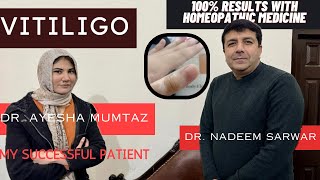 Vitiligo Treatment Leucoderma Homeopathic  Patient Treated  Dr Nadeem ft Dr Ayesha Mumtaz [upl. by Anirbas]