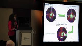 Retinitis Pigmentosa treatment [upl. by Ylime]