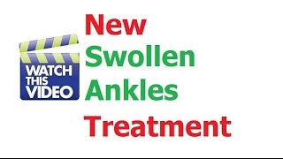 Best Swollen Ankles Treatment Stops Fluid Retention Edema and Puffy Ankles [upl. by Anabahs]