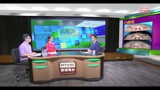 中大眼科 x 港台：莊金隆醫生講解甲狀腺眼病治療方案 [upl. by Netsruk492]