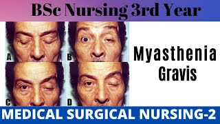 Myasthenia Gravis  MSN2  Medical Surgical Nursing  BSc Nursing 3rd Year  BSc Nursing in Hindi [upl. by Azeel]