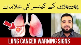 Lung Cancer Symptoms Explained How to Treat Lung Cancer  Phephron Ka Cancer ki Alamat aur Ilaj [upl. by Susana]