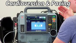 Lifepak 15 Part 3 Pacing and Cardioversion [upl. by Dahraf279]