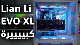 Lian Li O11D Evo XL أخيراً عملنا تجميعة بهذا الصندوق [upl. by Ronyam291]