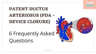 Patent ductus arteriosus6 Frequently Asked Questions [upl. by Adnorrehs]