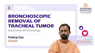 Bronchoscopic Tumor Debulking for Airway Fibroepithelial Polyp  Yashoda Hospitals Hyderabad [upl. by Hannad]