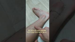 비골근 근막이완 Fibularis Longus Brevis SMR [upl. by Kerge]