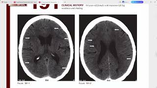 BRAIN IMAGING [upl. by Anoniw]