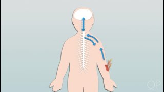 Pathophysiology of Pain by C Dowling  OPENPediatrics [upl. by Assilam]