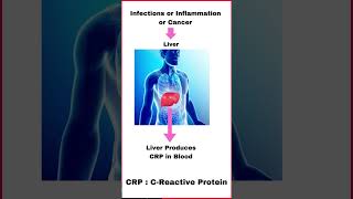 CRP कम कैसे करें   CReactive Protein  How to reduce CRP [upl. by Wren201]