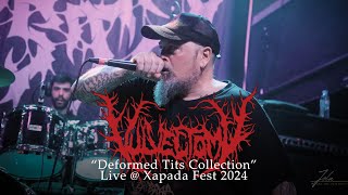 Vulvectomy quotDeformed Tits Collectionquot Live  Xapada Fest 2024 [upl. by Bertero]