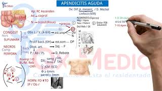 Ficha resumen Cirugía general Apendicitis aguda ENAMENARMSERUMS [upl. by Eiltan]