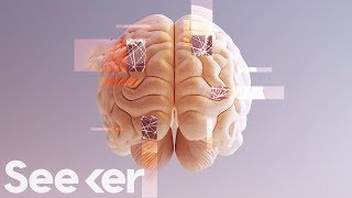 How Close Are We to a Complete Map of the Human Brain [upl. by Akfir657]