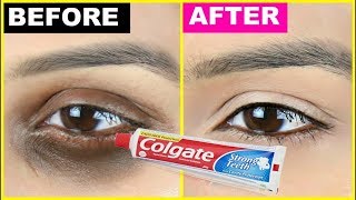 DARK CIRCLES REMOVER  Tamil Beauty Tips [upl. by Allak37]