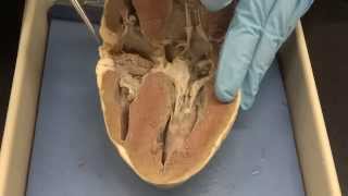 Cardiovascular system Part 3a  Heart dissection [upl. by Blunk879]