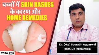 Baby skin rash causes amp home remedies  Neonatal Skin Care Tips [upl. by Notsua]