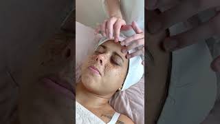 Vídeo completo no canal estetica limpezadepele skincare [upl. by Dibrin]