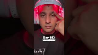 Day183 of Restoring Hairline using derma roller minoxidil topical Finasteride [upl. by Stricklan]