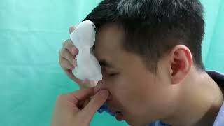 Epistaxis Educational Video [upl. by Ruthanne]