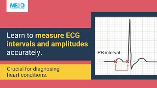 Interval and amplitude measurements [upl. by Tillo977]