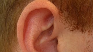 Determine If Ear Cartilage Is Infected  Ear Problems [upl. by Hteboj]